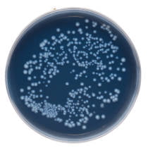 Legionella